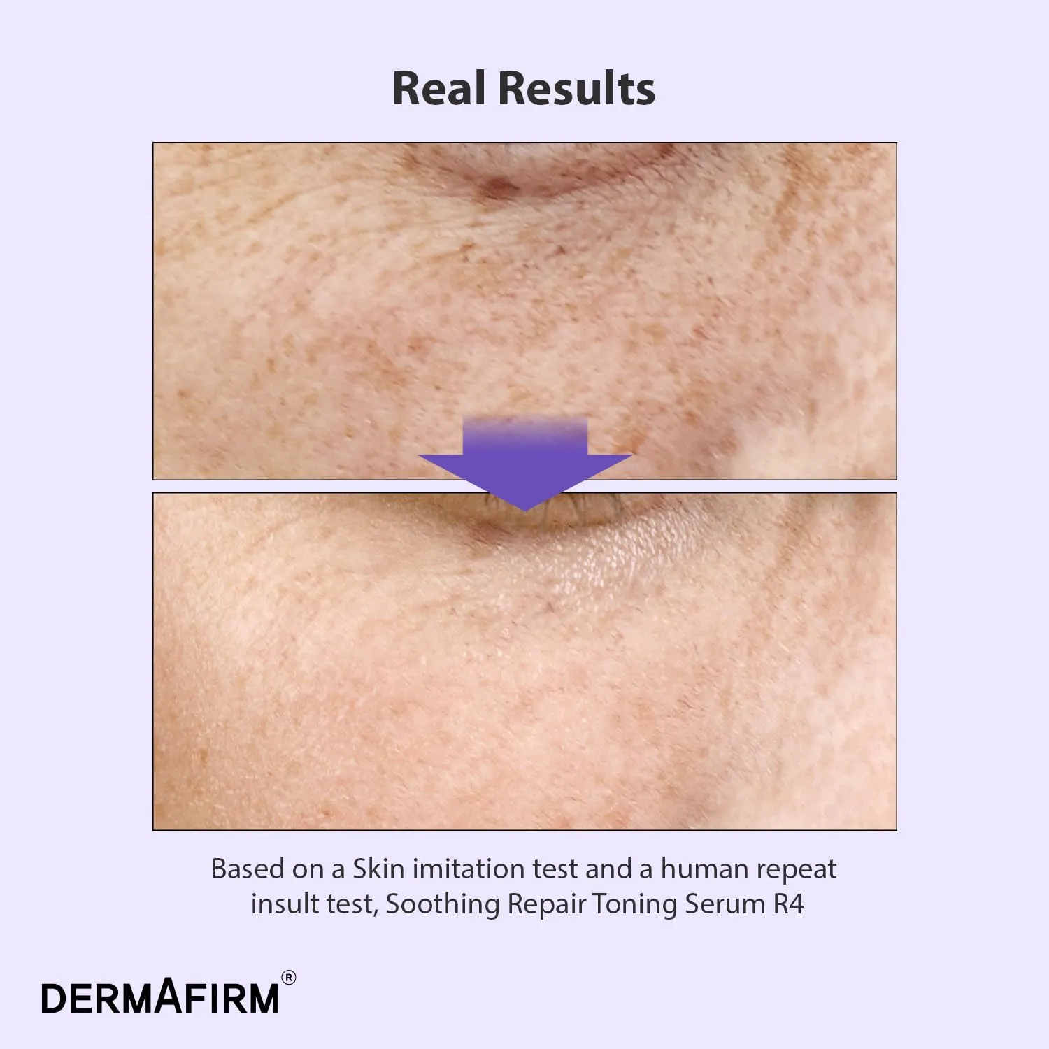 [Refill] DERMAFIRM Soothing Repair Toning Serum R4 - Korean Bakuchiol Retinol Niacinamide & Peptide Face Serum for Wrinkles - Calming, Moisturizing & Correcting- Paraben-Free, Cruelty-Free, 1.01 fl oz