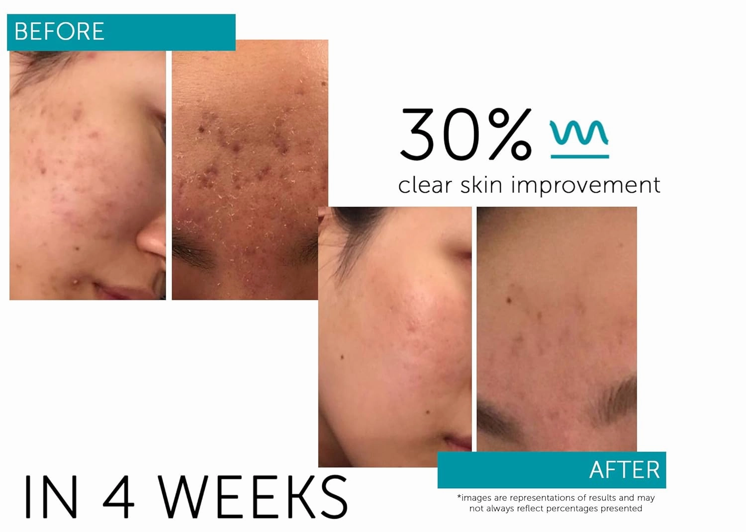 Regenerative Serum with Stem Cell Growth Factors, HGF for Skin Tightening and Smoothing, Wrinkle and Pore Reduction, and Rejuvenation - 1 fl oz/30ml
