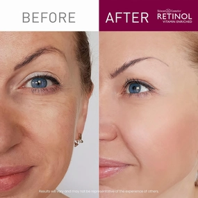 Retinol Age Minimizing Eye Gel with Vitamin A – Anti-Wrinkle Treatment – Lessen Puffiness and Dark Circles Around Eyes – Extra Boost of Retinol from Micro Beads Restore Tone and Elasticity to Eye Area