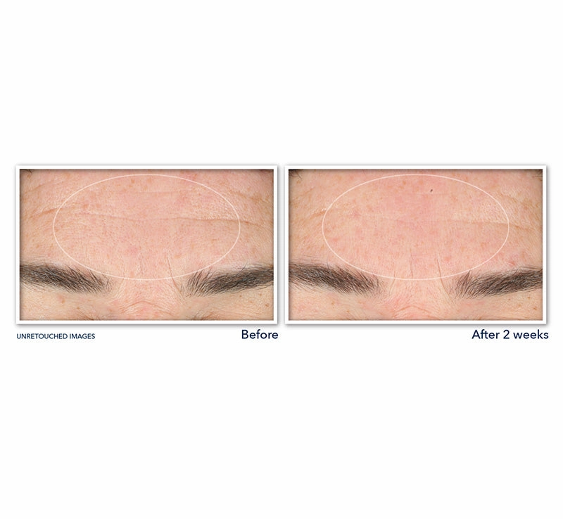 RETINOL CORREXION® DEEP WRINKLE SERUM CLEANSER
