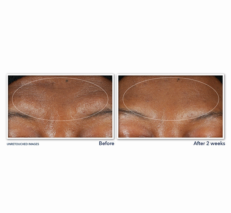 RETINOL CORREXION® DEEP WRINKLE SERUM CLEANSER
