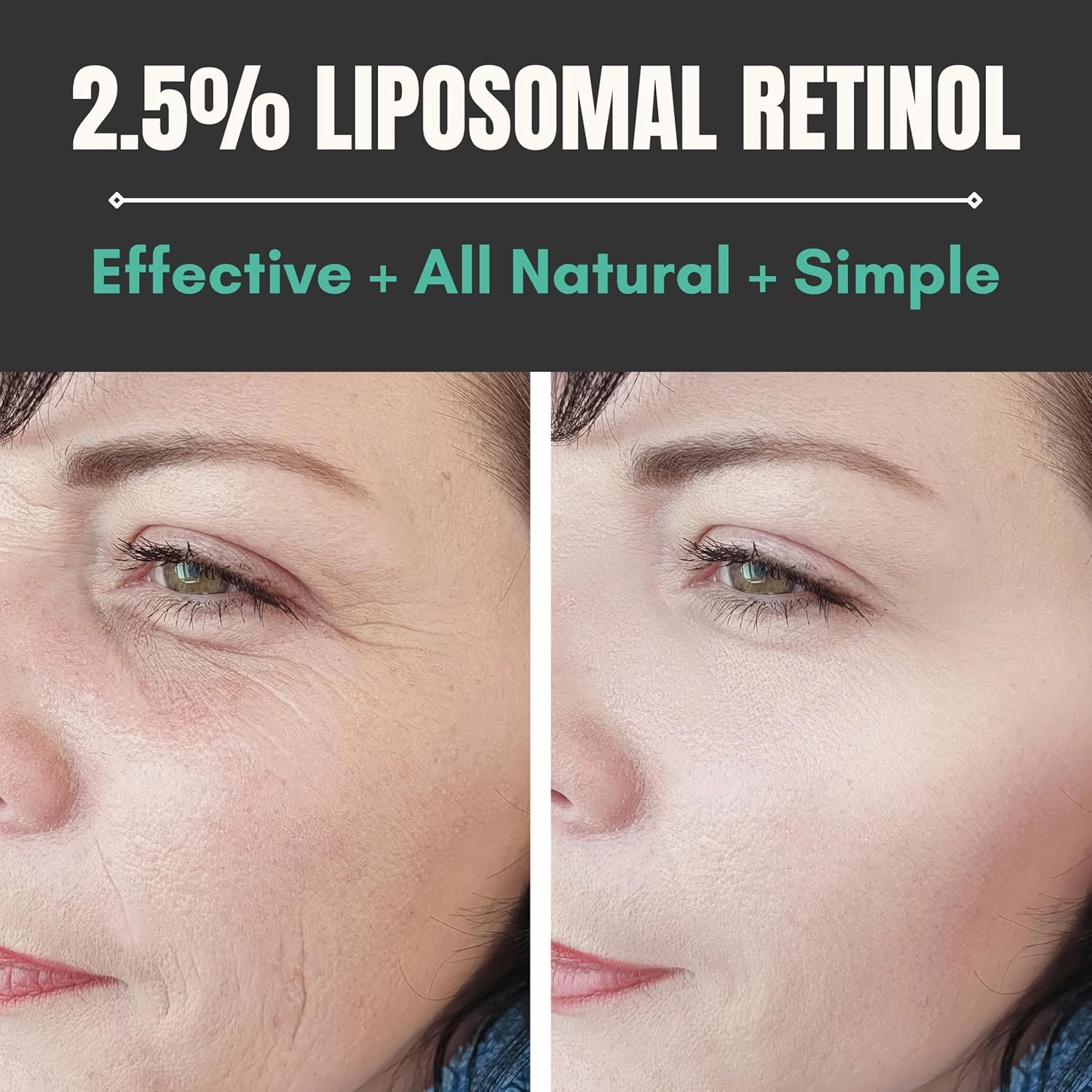 Retinol Serum - 2.5% Liposomal Retinol – Anti-Aging Face Serum – Reduces Wrinkles, Fine Lines & Dark Spots – Made in USA with Premium Ingredients – 1 fl oz