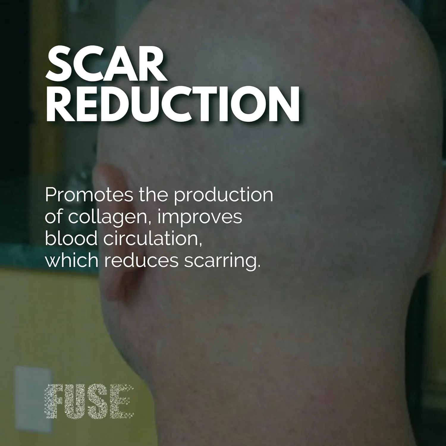 Scalp Micropigmentation Aftercare Lotion - Anti Shine Formula new and improved - Fast Absorbing and Fragrance Free - Made in The USA - 4oz