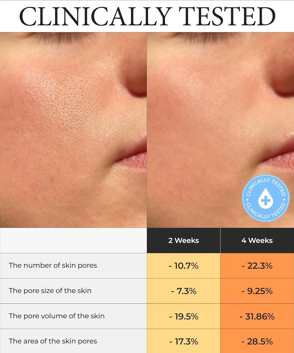 SERUMKIND Pore tightening and Refining Serum Korean Face Skincare - Natural Salicylic acid - Yellowmello Extract 92% -1 fl.oz.