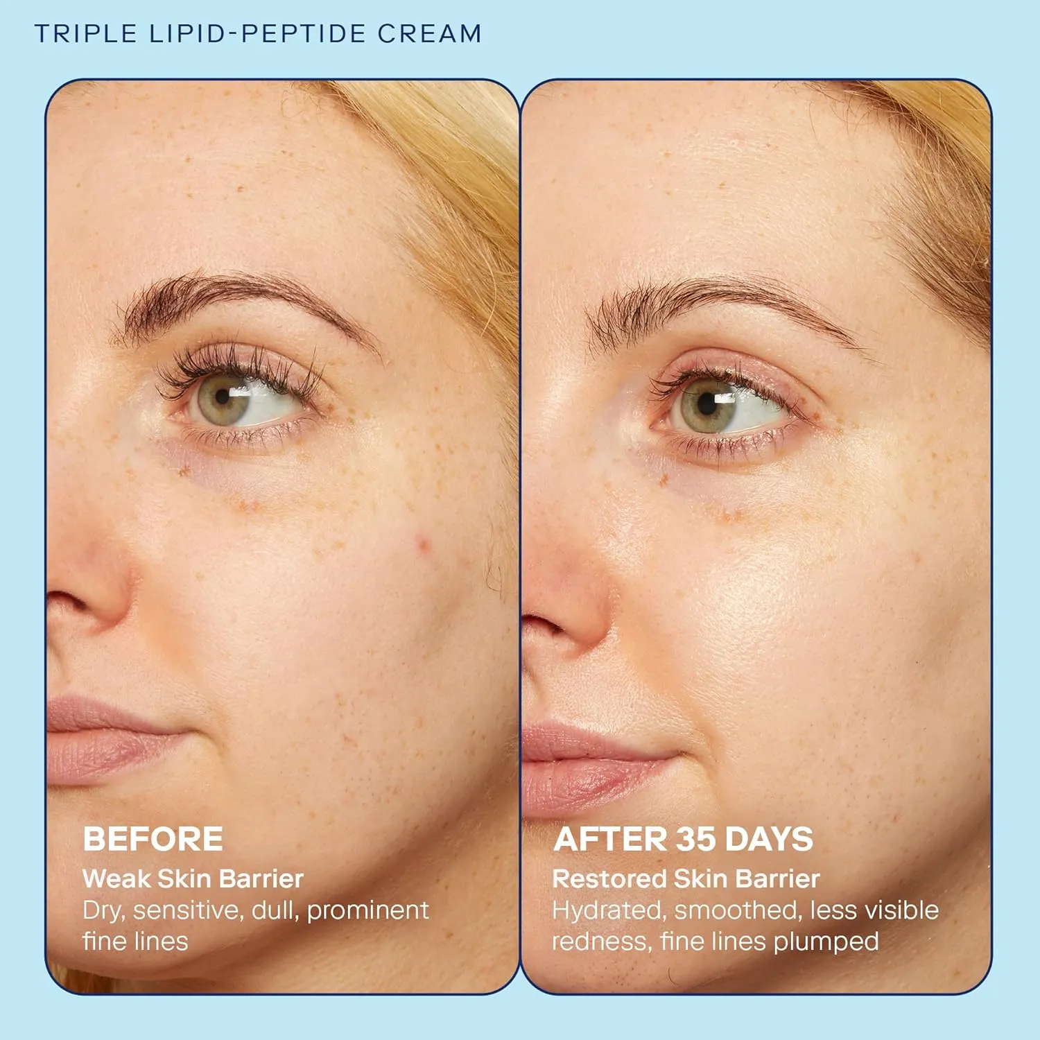 Skinfix Triple Lipid-Peptide Cream - 3.3 oz - Rich Face Moisturizer to Instantly Hydrate & Restore Dry, Sensitive Skin - Non-Comedogenic, Fragrance Free, Vegan, Cruelty Free