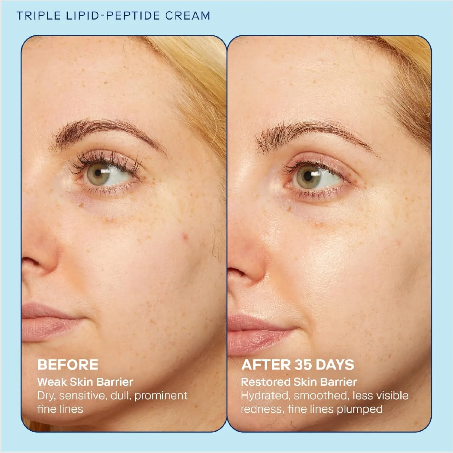Skinfix Triple Lipid-Peptide Cream Refill - 1.7 oz - Rich Face Moisturizer to Instantly Hydrate & Restore Dry, Sensitive Skin - Non-Comedogenic, Fragrance Free, Vegan, Cruelty Free