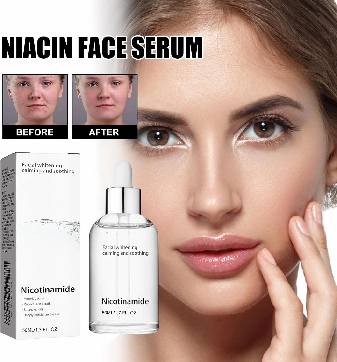 Sunnylas Niacinamide Freckles Removal Serum, Niacinamide Serum for Face and Body, Freckles Removal, Hydrating and Moisturizing Facial Essence for All Type Skin