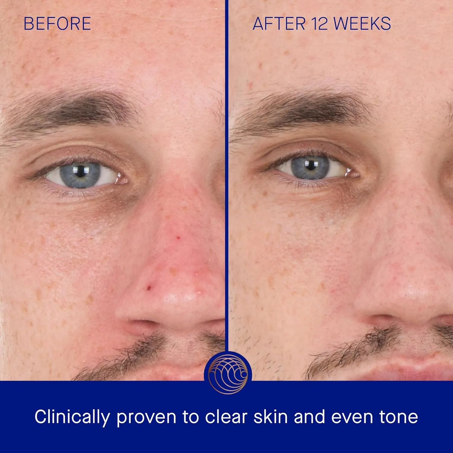 The Retinol Serum