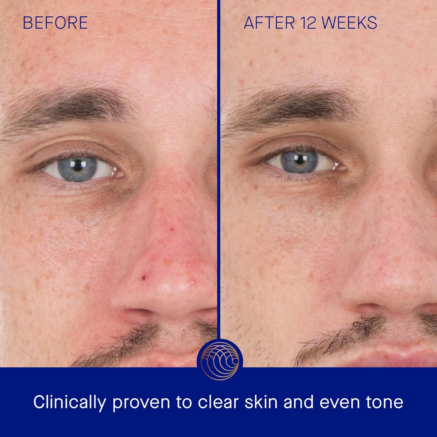 The Retinol Serum
