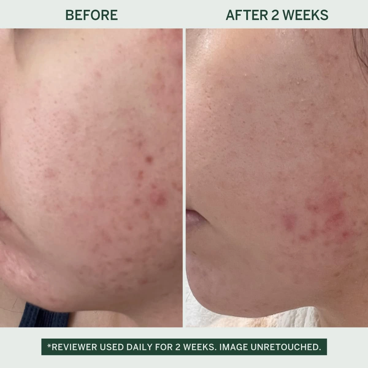 Urban Calm Hydrating Vita Serum - Glow Boosting Facial Serum with Fermented Mung Bean & 10% Niacinamide for Fine Lines & Wrinkles - Plump & Revive Dry Skin - Smoothing & Calming - 30ml / 1.01 fl oz
