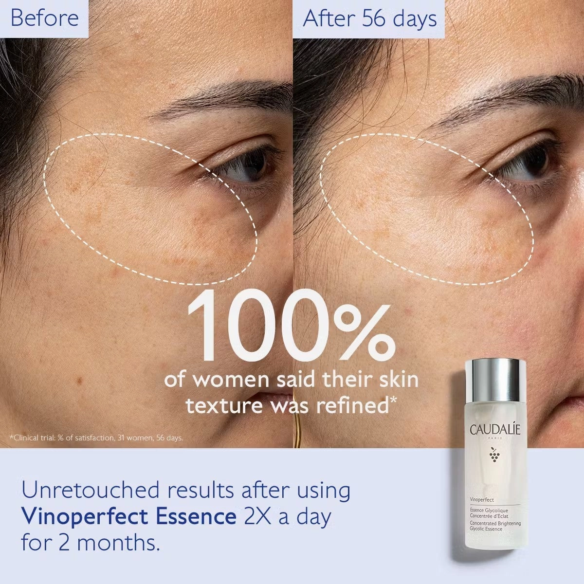 Vinoperfect Concentrated Brightening Glycolic Essence