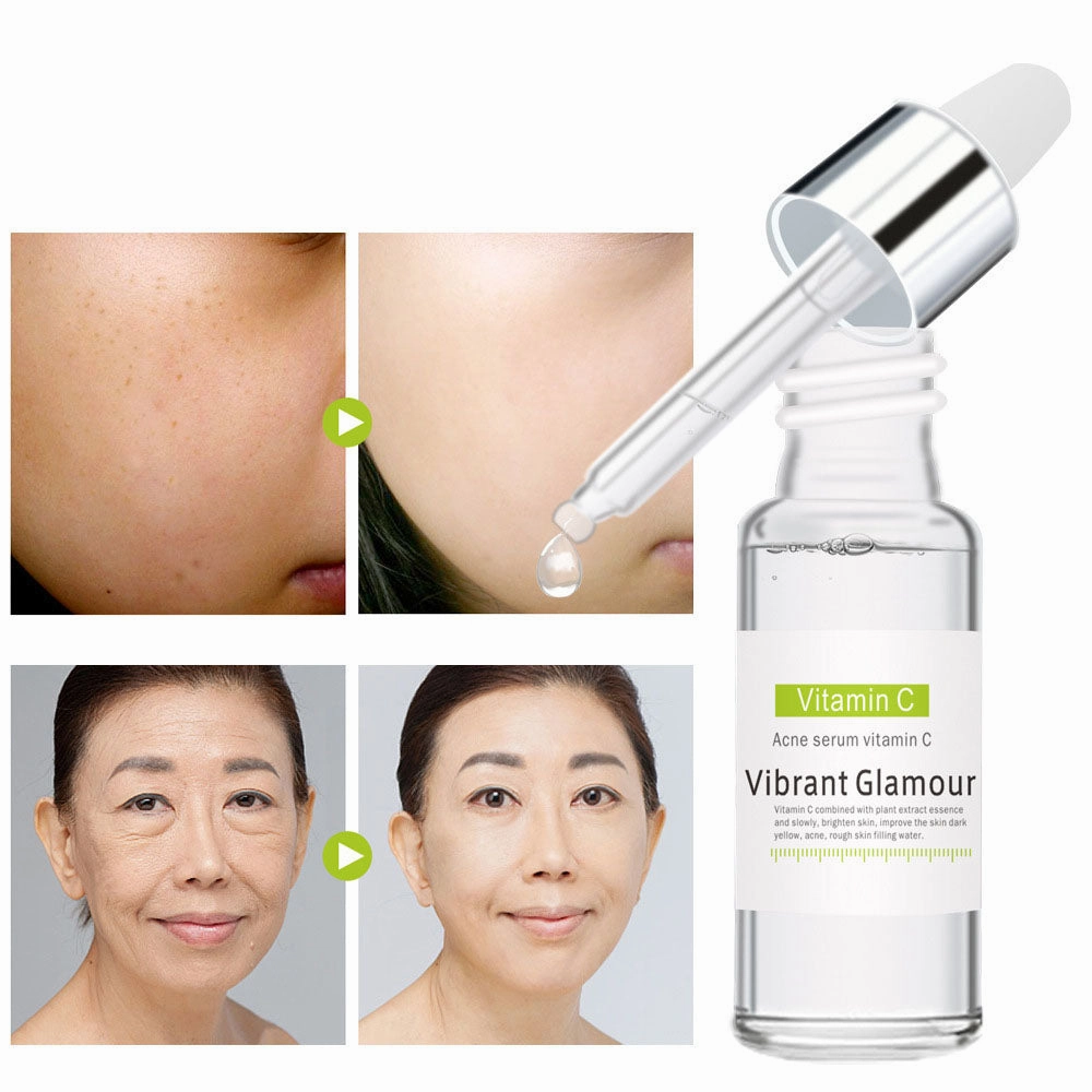 Vitamin C Acne Essence – Pore Minimizing & Hydrating Serum