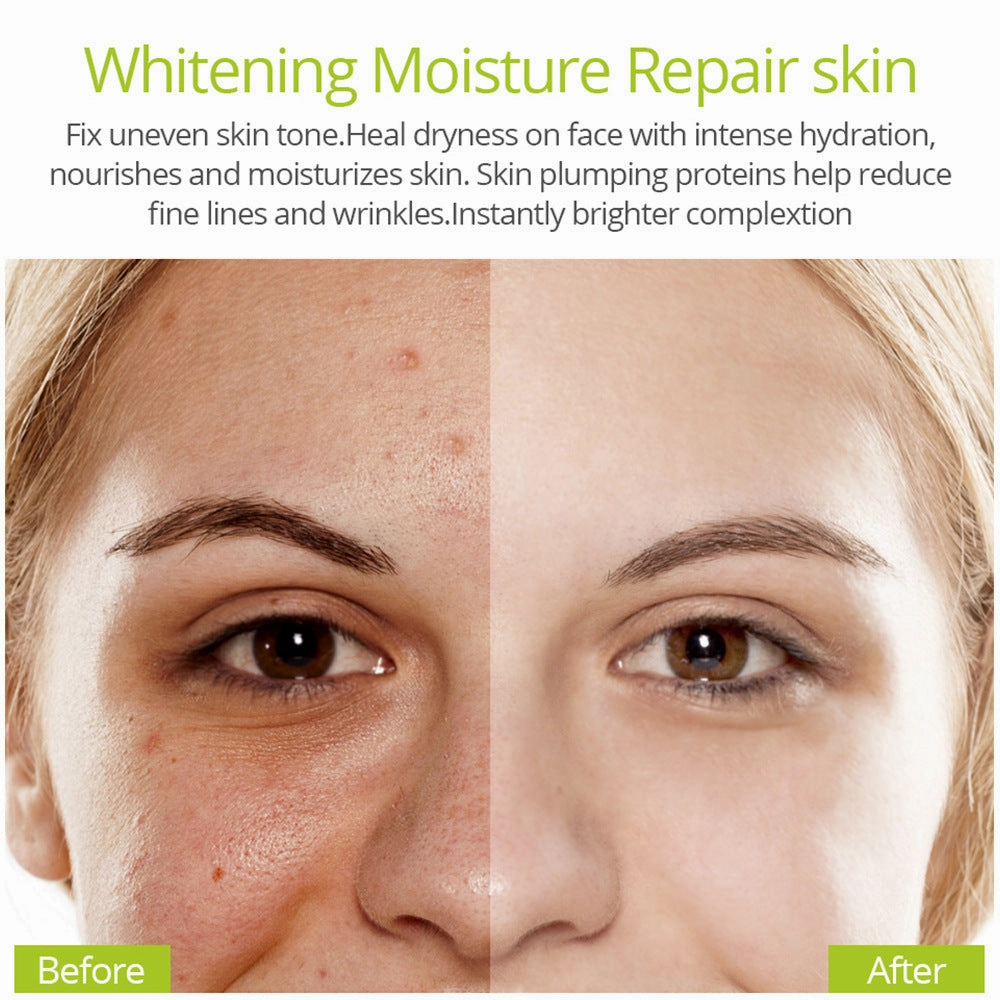 Vitamin C Acne Essence – Pore Minimizing & Hydrating Serum